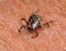 American dog tick crawling on a person's skin